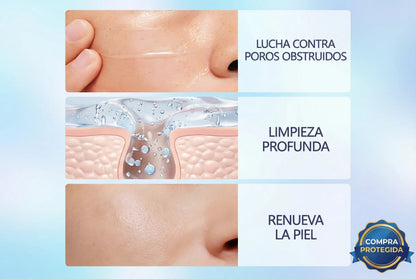 Quarxery Piel Perfecta™ – Exfoliante Facial Intensivo