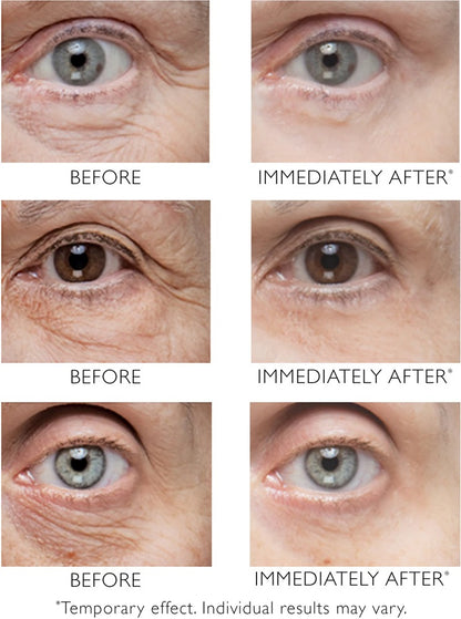 Instant FIRMx® Eye Skinface Firmeza Instantánea de Alta Precisión